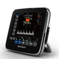 Ultraschall-Scanner Farb-Doppler Laptop Touchscreen (SC-ST30)